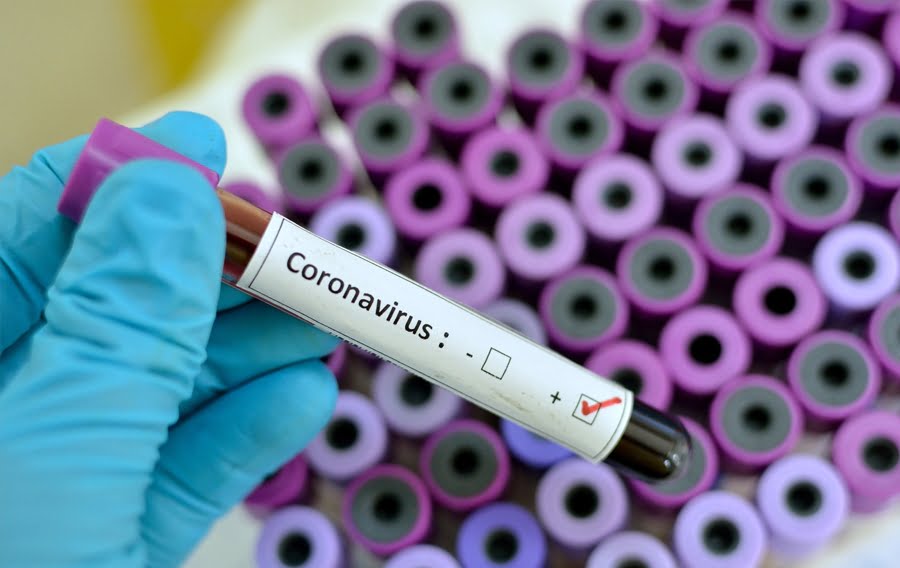 Blood test for Corona virus with PPE